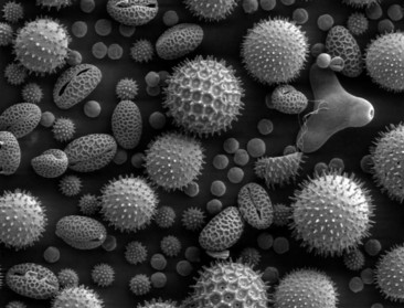 granulos de polen al microscopio