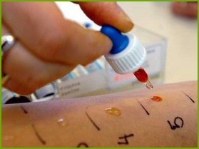 pruebas de alergia básicas (prick test)